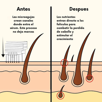 RegenCapilar™ - Protocolo clínico recuperación capilar para uso en casa - RegenCapilar